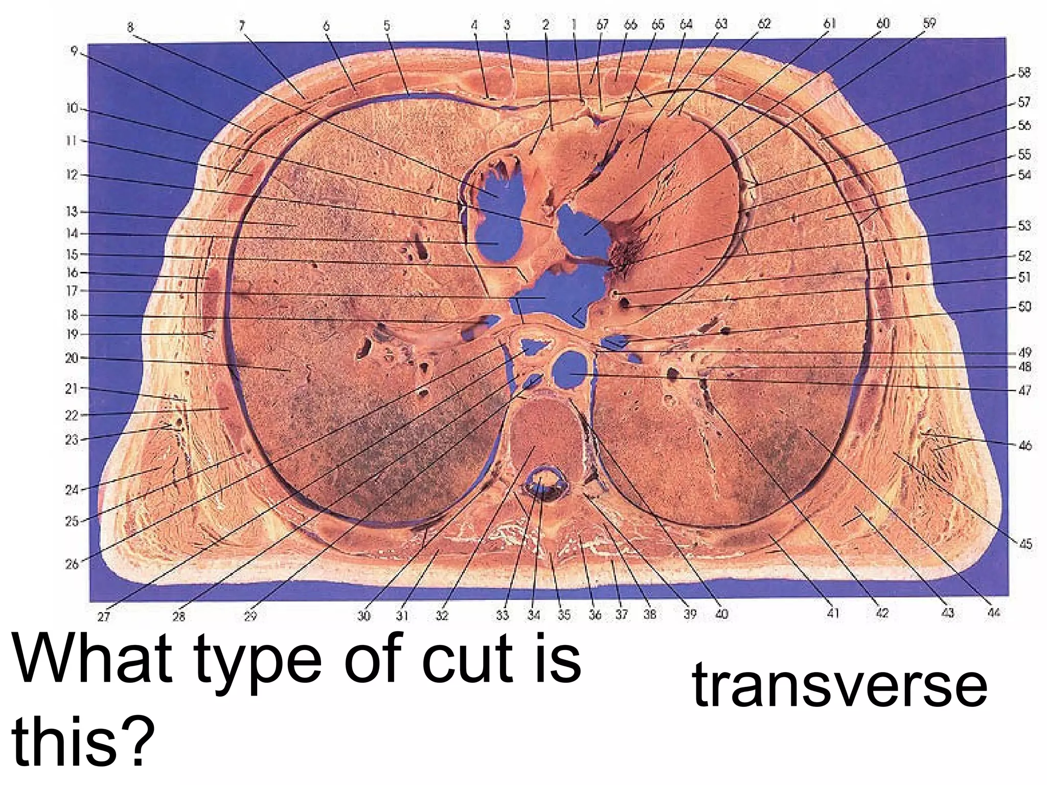 What type of cut is
this?
transverse
 