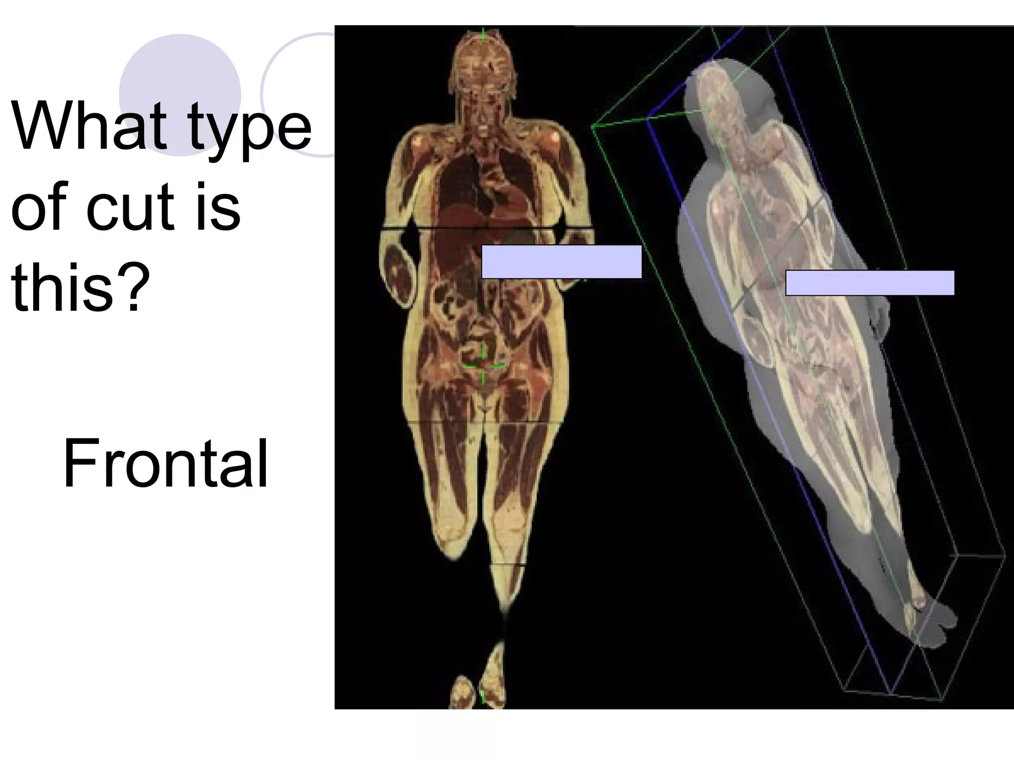 Frontal
What type
of cut is
this?
 
