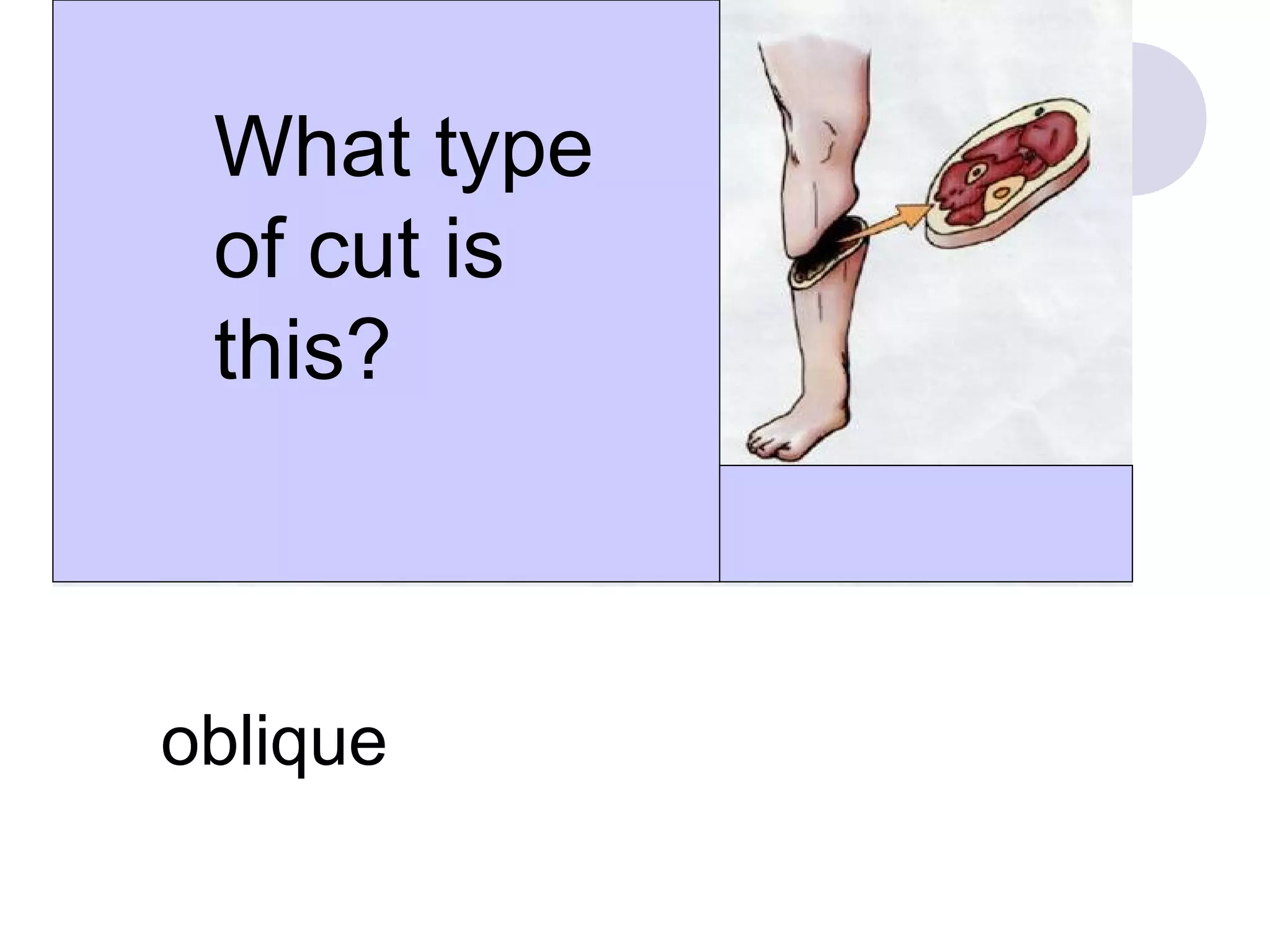 What type
of cut is
this?
oblique
 