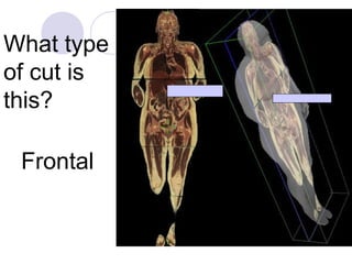 Chapter 1 notes Intro to Anatomy and Physiology | PPT