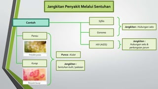 Jangkitan Penyakit Melalui Sentuhan
Contoh
Panau
Punca : Kulat
Kurap
Sifilis
Gonorea
Jangkitan : Hubungan seks
Jangkitan :
Sentuhan kulit / pakaian
HIV (AIDS)
Jangkitan :
Hubungan seks &
perkongsian jarum
 