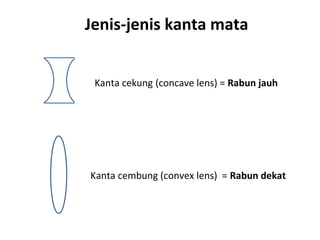 Jenis-jenis kanta mata


KKanta cekung (concave lens) = Rabun jauh




Kanta cembung (convex lens) = Rabun dekat
 