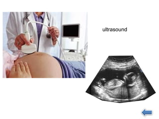 ultrasound
 
