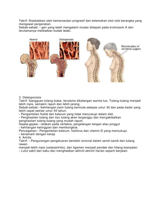 Takrif: Disebabkan oleh kemerosotan progresif dan kelemahan otot -otot berangka yang
mengawal pergerakan.
Sebab-sebab: - gen yang telah mengalami mutasi didapati pada kromosom X dan
terutamanya melibatkan budak lelaki.




3. Osteoporosis
Takrif: Gangguan tulang biasa, terutama dikalangan wanita tua. Tulang -tulang menjadi
lebih nipis, semakin rapuh dan lebih jarang.
Sebab-sebab:- Kehilangan jisim tulang bermula selepas umur 30 dan pada kadar yang
lebih cepat sekitar umur 45 tahun.
- Pengambilan fosfat dan kalsium yang tidak mencukupi dalam diet.
- Penghasilan tulang dan tisu tulang akan terganggu dan mengakibatkan
penghasilan tulang-tulang yang mudah rapuh.
Gejala-gejala:- retakan pada vertebra, pergelangan tangan atau pinggul
- kehilangan ketinggian dan membongkok.
Pencegahan:- Pengambilan kalsium, fosforus dan vitamin D yang mencukupi.
- bersenam dengan kerap
4. Artritis
Takrif: - Pengurangan pengeluaran bendalir sinovial dalam sendi-sendi dan tulang
rawan
menjadi lebih nipis (osteoartritis), dan ligamen menjadi pendek dan hilang keanjalan.
- Lutut sakit dan kaku dan menghadkan aktiviti-aktiviti harian seperti berjalan.
 