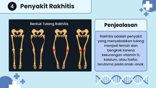 Kaki Rakhitis MATERI IPAS KELAS 6 SEKOLAH DASAR: SISTEM SARAF | PDF