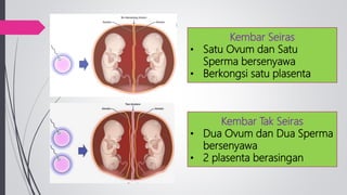 Kembar Seiras
• Satu Ovum dan Satu
Sperma bersenyawa
• Berkongsi satu plasenta
Kembar Tak Seiras
• Dua Ovum dan Dua Sperma
bersenyawa
• 2 plasenta berasingan
 