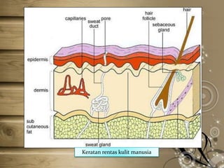 Keratan rentas kulit manusia

 