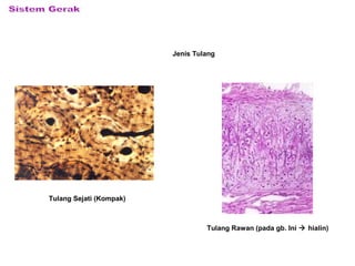 Jenis Tulang
Tulang Sejati (Kompak)
Tulang Rawan (pada gb. Ini  hialin)
 
