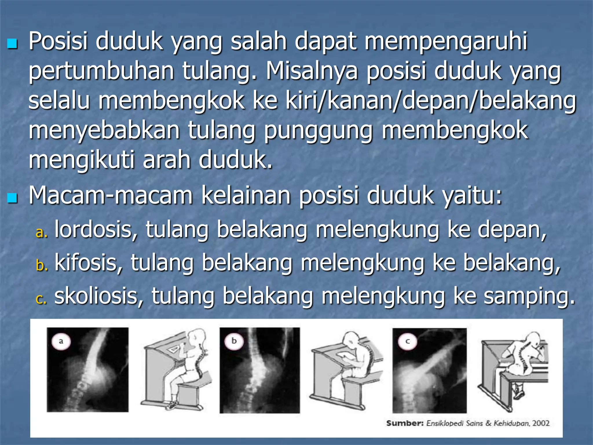  Posisi duduk yang salah dapat mempengaruhi
pertumbuhan tulang. Misalnya posisi duduk yang
selalu membengkok ke kiri/kanan/depan/belakang
menyebabkan tulang punggung membengkok
mengikuti arah duduk.
 Macam-macam kelainan posisi duduk yaitu:
a. lordosis, tulang belakang melengkung ke depan,
b. kifosis, tulang belakang melengkung ke belakang,
c. skoliosis, tulang belakang melengkung ke samping.
 