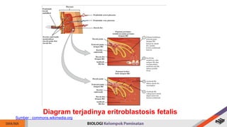 Diagram terjadinya eritroblastosis fetalis
Sumber : commons.wikimedia.org
 