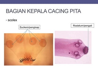 BAGIAN KEPALA CACING PITA
• scolex
Rostelum/pengait
Suckers/pengisap
 