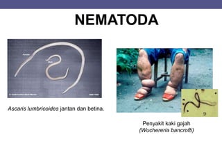 NEMATODA
Ascaris lumbricoides jantan dan betina.
Penyakit kaki gajah
(Wuchereria bancrofti)
 