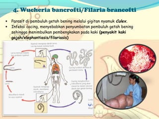 4. Wucheria bancrofti/Filaria brancofti
•
•

 

Parasit di pembuluh getah bening melalui gigitan nyamuk Culex.
Infeksi cacing, menyebabkan penyumbatan pembuluh getah bening
sehingga menimbulkan pembengkakan pada kaki (penyakit kaki
gajah/elephantiasis/filariasis)

 
