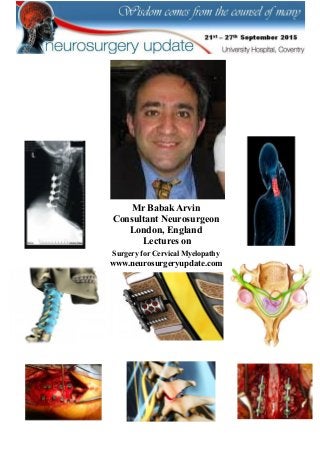 Mr Babak Arvin
Consultant Neurosurgeon
London, England
Lectures on
Surgery for Cervical Myelopathy
www.neurosurgeryupdate.com
 