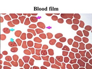 Blood film
 