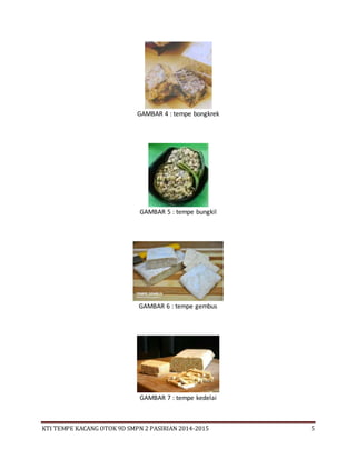 KTI TEMPE KACANG OTOK 9D SMPN 2 PASIRIAN 2014-2015 5
GAMBAR 4 : tempe bongkrek
GAMBAR 5 : tempe bungkil
GAMBAR 6 : tempe gembus
GAMBAR 7 : tempe kedelai
 