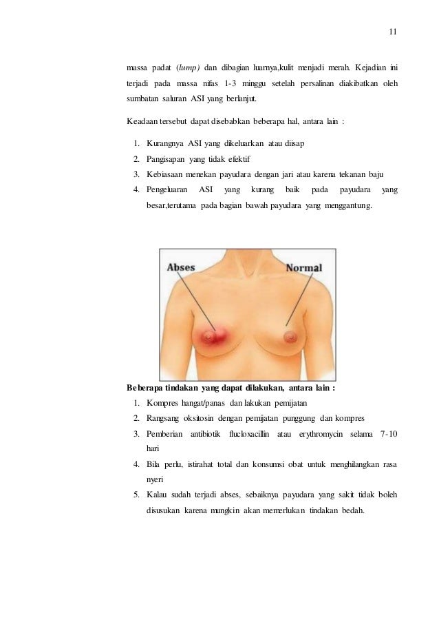 Gambar Perawatan Payudara Perawatan Payudara