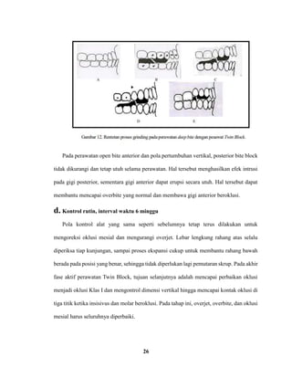 26
Pada perawatan open bite anterior dan pola pertumbuhan vertikal, posterior bite block
tidak dikurangi dan tetap utuh selama perawatan. Hal tersebut menghasilkan efek intrusi
pada gigi posterior, sementara gigi anterior dapat erupsi secara utuh. Hal tersebut dapat
membantu mencapai overbite yang normal dan membawa gigi anterior beroklusi.
d. Kontrol rutin, interval waktu 6 minggu
Pola kontrol alat yang sama seperti sebelumnya tetap terus dilakukan untuk
mengoreksi oklusi mesial dan mengurangi overjet. Lebar lengkung rahang atas selalu
diperiksa tiap kunjungan, sampai proses ekspansi cukup untuk membantu rahang bawah
berada pada posisi yang benar, sehingga tidak diperlukan lagi pemutaran skrup. Pada akhir
fase aktif perawatan Twin Block, tujuan selanjutnya adalah mencapai perbaikan oklusi
menjadi oklusi Klas I dan mengontrol dimensi vertikal hingga mencapai kontak oklusi di
tiga titik ketika insisivus dan molar beroklusi. Pada tahap ini, overjet, overbite, dan oklusi
mesial harus seluruhnya diperbaiki.
 