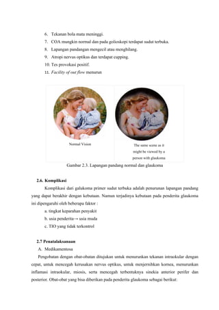 6. Tekanan bola mata meninggi.
       7. COA mungkin normal dan pada golioskopi terdapat sudut terbuka.
       8. Lapangan pandangan mengecil atau menghilang.
       9. Atropi nervus optikus dan terdapat cupping.
       10. Tes provokasi positif.
       11. Facility of out flow menurun




                     Normal Vision                      The same scene as it
                                                        might be viewed by a
                                                        person with glaukoma

                    Gambar 2.3. Lapangan pandang normal dan glaukoma


  2.6. Komplikasi
       Komplikasi dari galukoma primer sudut terbuka adalah penurunan lapangan pandang
yang dapat berakhir dengan kebutaan. Namun terjadinya kebutaan pada penderita glaukoma
ini dipengaruhi oleh beberapa faktor :
       a. tingkat keparahan penyakit
       b. usia penderita→ usia muda
       c. TIO yang tidak terkontrol


  2.7 Penatalaksanaan
   A. Medikamentosa
   Pengobatan dengan obat-obatan ditujukan untuk menurunkan tekanan intraokular dengan
cepat, untuk mencegah kerusakan nervus optikus, untuk menjernihkan kornea, menurunkan
inflamasi intraokular, miosis, serta mencegah terbentuknya sinekia anterior perifer dan
posterior. Obat-obat yang bisa diberikan pada penderita glaukoma sebagai berikut:
 