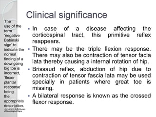 Clinical significance
 In case of a disease affecting the
corticospinal tract, this primitive reflex
reappears.
 There may be the triple flexion response.
There may also be contraction of tensor facia
lata thereby causing a internal rotation of hip.
 Brissaud reflex, abduction of hip due to
contraction of tensor fascia lata may be used
specially in patients where great toe is
missing.
 A bilateral response is known as the crossed
flexor response.
The
use of the
term
‘negative
Babinski
sign’ to
indicate the
normal
finding of a
downgoing
big toe is
incorrect,
‘flexor
plantar
response’
being
the
appropriate
description.
-A J Larner in A Dictionary
of Neurological Signs
 