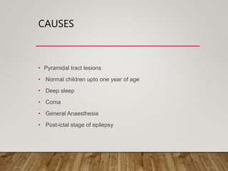 CAUSES
• Pyramidal tract lesions
• Normal children upto one year of age
• Deep sleep
• Coma
• General Anaesthesia
• Post-ictal stage of epilepsy
 
