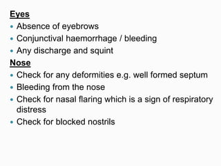 Eyes
 Absence of eyebrows
 Conjunctival haemorrhage / bleeding
 Any discharge and squint
Nose
 Check for any deformities e.g. well formed septum
 Bleeding from the nose
 Check for nasal flaring which is a sign of respiratory
distress
 Check for blocked nostrils
 