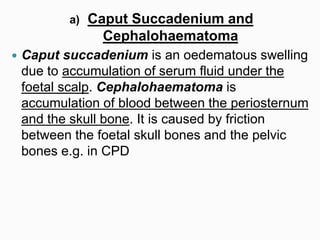 a) Caput Succadenium and
Cephalohaematoma
 Caput succadenium is an oedematous swelling
due to accumulation of serum fluid under the
foetal scalp. Cephalohaematoma is
accumulation of blood between the periosternum
and the skull bone. It is caused by friction
between the foetal skull bones and the pelvic
bones e.g. in CPD
 