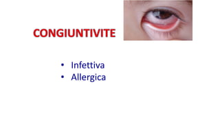 • Infettiva
• Allergica
 