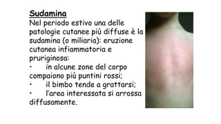 Sudamina
Nel periodo estivo una delle
patologie cutanee più diffuse è la
sudamina (o miliaria): eruzione
cutanea infiammatoria e
pruriginosa:
• in alcune zone del corpo
compaiono più puntini rossi;
• il bimbo tende a grattarsi;
• l’area interessata si arrossa
diffusamente.
 