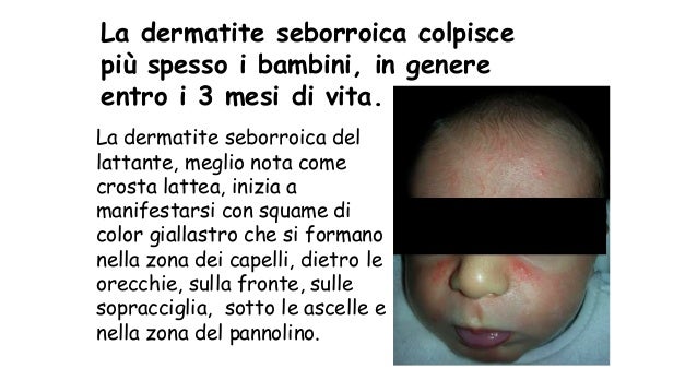 Come vincere la psoriasi un forum
