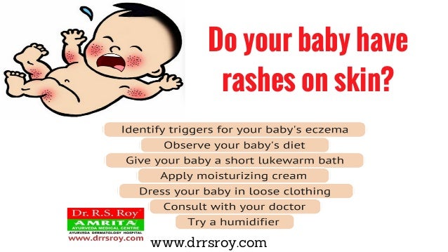 baby skin infection cream