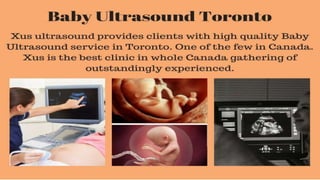 Baby ultrasound toronto