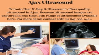 Baby ultrasound toronto