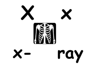 X    x

x-   ray
 