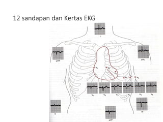 12 sandapan dan Kertas EKG
 