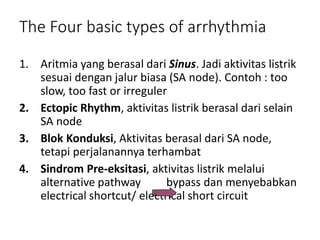 The Four basic types of arrhythmia
1. Aritmia yang berasal dari Sinus. Jadi aktivitas listrik
sesuai dengan jalur biasa (SA node). Contoh : too
slow, too fast or irreguler
2. Ectopic Rhythm, aktivitas listrik berasal dari selain
SA node
3. Blok Konduksi, Aktivitas berasal dari SA node,
tetapi perjalanannya terhambat
4. Sindrom Pre-eksitasi, aktivitas listrik melalui
alternative pathway bypass dan menyebabkan
electrical shortcut/ electrical short circuit
 