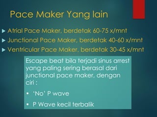 Pace Maker Yang lain
 Atrial Pace Maker, berdetak 60-75 x/mnt
 Junctional Pace Maker, berdetak 40-60 x/mnt
 Ventricular Pace Maker, berdetak 30-45 x/mnt
Escape beat bila terjadi sinus arrest
yang paling sering berasal dari
junctional pace maker, dengan
ciri :
• ‘No’ P wave
• P Wave kecil terbalik
 
