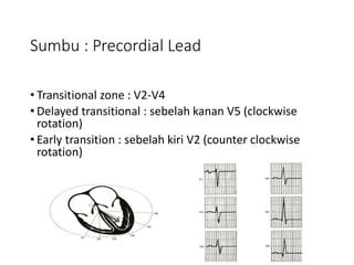 Sumbu : Precordial Lead
• Transitional zone : V2-V4
• Delayed transitional : sebelah kanan V5 (clockwise
rotation)
• Early transition : sebelah kiri V2 (counter clockwise
rotation)
 
