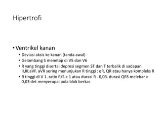Hipertrofi
•Ventrikel kanan
• Deviasi aksis ke kanan (tanda awal)
• Gelombang S menetap di V5 dan V6
• R yang tinggi disertai depresi segmen ST dan T terbalik di sadapan
II,III,aVF. aVR sering menunjukan R tinggi : qR, QR atau hanya kompleks R
• R tinggi di V 1. ratio R/S > 1 atau durasi R . 0,03. durasi QRS melebar >
0,03 det menyerupai pola blok berkas
 