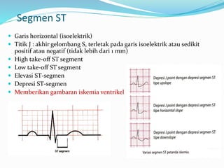 Segmen ST
 Garis horizontal (isoelektrik)
 Titik J : akhir gelombang S, terletak pada garis isoelektrik atau sedikit
positif atau negatif (tidak lebih dari 1 mm)
 High take-off ST segment
 Low take-off ST segment
 Elevasi ST-segmen
 Depresi ST-segmen
 Memberikan gambaran iskemia ventrikel
 