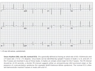 Baca EKG.pdf