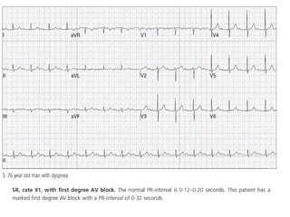 Baca EKG.pdf