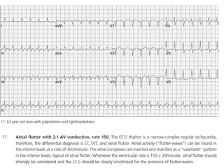 Baca EKG.pdf