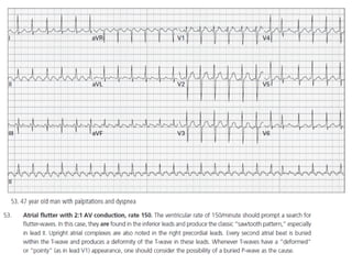 Baca EKG.pdf
