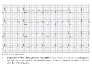 Baca EKG.pdf