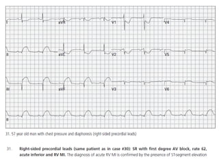 Baca EKG.pdf