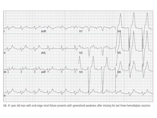 Baca EKG.pdf