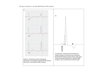 Baca EKG.pdf