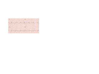 Baca EKG.pdf