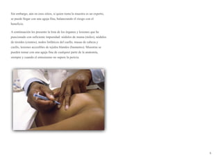 Sin embargo, aún en esos sitios, si quien toma la muestra es un experto,
se puede llegar con una aguja fina, balanceando el riesgo con el
beneficio.
A continuación les presento la lista de los órganos y lesiones que he
puncionado con suficiente impunidad: nódulos de mama (miles), nódulos
de tiroides (cientos), nodos linfáticos del cuello, masas de cabeza y
cuello, lesiones accesibles de tejidos blandos (bastantes). Muestras se
pueden tomar con una aguja fina de cualquier parte de la anatomía,
siempre y cuando el entusiasmo no supere la pericia.
5
 